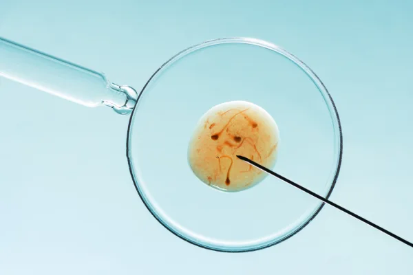 Fertility Preservation Fertility Preservation